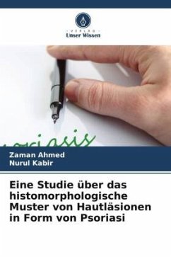 Eine Studie über das histomorphologische Muster von Hautläsionen in Form von Psoriasi - Ahmed, Zaman;Kabir, Nurul