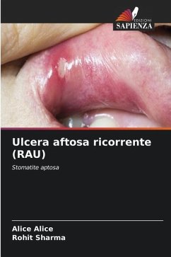 Ulcera aftosa ricorrente (RAU) - Alice, Alice;Sharma, Rohit