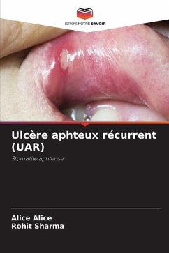 Ulcère aphteux récurrent (UAR) - Alice, Alice;Sharma, Rohit