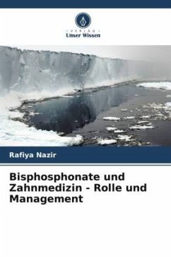 Bisphosphonate und Zahnmedizin - Rolle und Management - Nazir, Rafiya