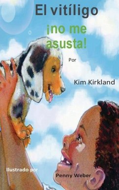 El vitiligo no me asusta - Kirkland, Kim