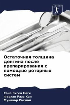 Ostatochnaq tolschina dentina posle preparirowaniq s pomosch'ü rotornyh sistem - Nagi, Sana Jehsen;Han, Farhan Raza;Rahman, Munawar