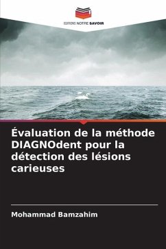 Évaluation de la méthode DIAGNOdent pour la détection des lésions carieuses - Bamzahim, Mohammad