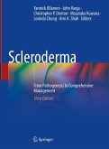 Scleroderma (eBook, PDF)