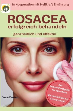 Rosacea erfolgreich behandeln - ganzheitlich und effektiv: Der Selbsthilferatgeber für Betroffene mit Tipps, die wirklich funktionieren - Vera Enzian