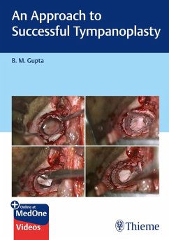Cover An Approach to Successful Tympanoplasty (eBook, PDF)