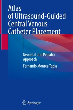 Atlas of Ultrasound-Guided Central Venous Catheter Placement - Montes-Tapia, Fernando