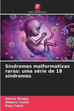 Síndromes malformativas raras: uma série de 18 síndromes - Mnejja, Amina;Toumi, Dhekra;Faleh, Raja