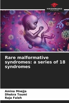 Rare malformative syndromes: a series of 18 syndromes - Mnejja, Amina;Toumi, Dhekra;Faleh, Raja