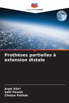 Prothèses partielles à extension distale - Sikri, Arpit;Pawah, Salil;Pathak, Chetan