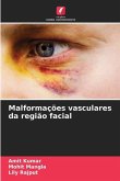 Malformações vasculares da região facial