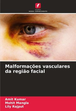 Cover Malformações vasculares da região facial