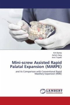 Mini-screw Assisted Rapid Palatal Expansion (MARPE) - Banka, Kirti;Garg, Ashish;Tripathi, Amit