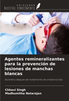 Cover Agentes remineralizantes para la prevención de lesiones de manchas blancas