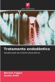 Tratamento endodôntico