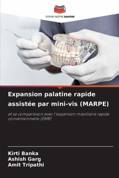 Expansion palatine rapide assistée par mini-vis (MARPE) - Banka, Kirti;Garg, Ashish;Tripathi, Amit