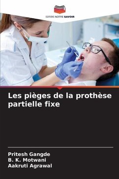 Les pièges de la prothèse partielle fixe - Gangde, Pritesh;Motwani, B. K.;Agrawal, Aakruti