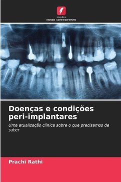 Doenças e condições peri-implantares - Rathi, Prachi