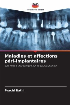 Maladies et affections péri-implantaires - Rathi, Prachi