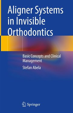 Aligner Systems in Invisible Orthodontics (eBook, PDF) - Abela, Stefan