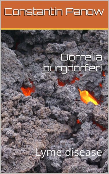 Borrelia Burgdorferi-Lyme Disease (eBook, ePUB) Borrelia Burgdorferi-Lyme Disease (eBook, ePUB)