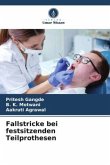 Fallstricke bei festsitzenden Teilprothesen