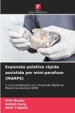 Expansão palatina rápida assistida por mini-parafuso (MARPE)