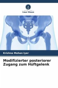 Modifizierter posteriorer Zugang zum Hüftgelenk - Iyer, Krishna Mohan
