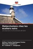 Malocclusions chez les écoliers noirs