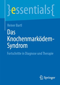 Das Knochenmarködem-Syndrom (eBook, PDF) - Bartl, Reiner