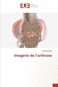 Imagerie de l¿arthrose - Aoudia, Lynda