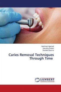 Caries Removal Techniques Through Time