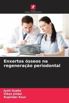 Enxertos ósseos na regeneração periodontal - Gupta, Jyoti;Jindal, Vikas;Kaur, Rupinder