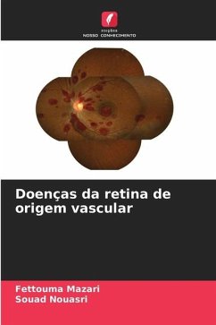 Doenças da retina de origem vascular - Mazari, Fettouma;Nouasri, Souad