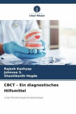 CBCT ¿ Ein diagnostisches Hilfsmittel - Kashyap, Rajesh;S., Johnvee;Hegde, Shashikanth