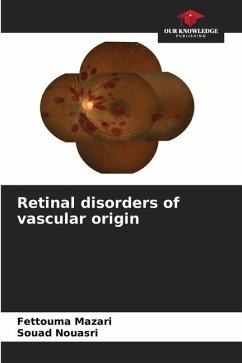 Retinal disorders of vascular origin - Mazari, Fettouma;Nouasri, Souad