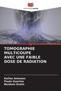 TOMOGRAPHIE MULTICOUPE AVEC UNE FAIBLE DOSE DE RADIATION - Antunes, Kaline;Guerino, Paula;Grehs, Renésio