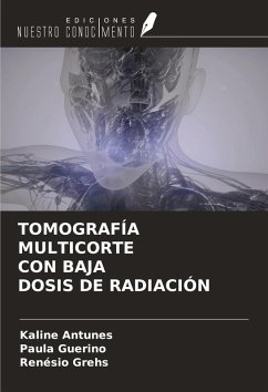 Cover TOMOGRAFÍA MULTICORTE CON BAJA DOSIS DE RADIACIÓN
