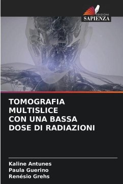 TOMOGRAFIA MULTISLICE CON UNA BASSA DOSE DI RADIAZIONI - Antunes, Kaline;Guerino, Paula;Grehs, Renésio