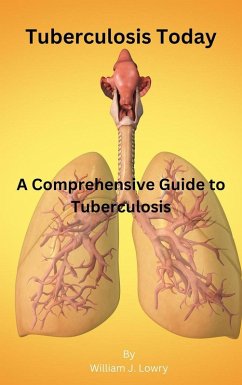 Tuberculosis Today (eBook, ePUB) - Lowry, William J.