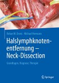 Halslymphknotenentfernung – Neck-Dissection (eBook, PDF)