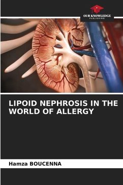 LIPOID NEPHROSIS IN THE WORLD OF ALLERGY - BOUCENNA, Hamza