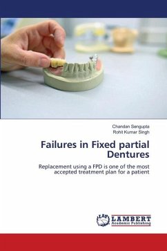 Failures in Fixed partial Dentures - Sengupta, Chandan;Singh, Rohit Kumar