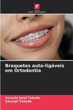 Braquetes auto-ligáveis em Ortodontia - Jatol-Tekade, Suruchi;Tekade, Satyajit