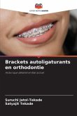 Brackets autoligaturants en orthodontie