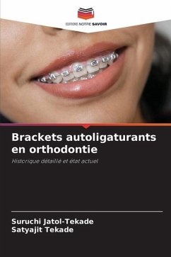 Brackets autoligaturants en orthodontie - Jatol-Tekade, Suruchi;Tekade, Satyajit