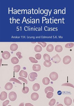Cover Haematology and the Asian Patient (eBook, PDF)