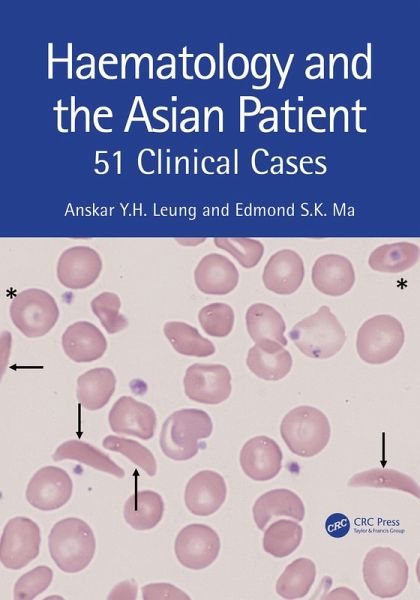 Haematology and the Asian Patient (eBook, ePUB)