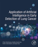 Application of Artificial Intelligence in Early Detection of Lung Cancer (eBook, ePUB)