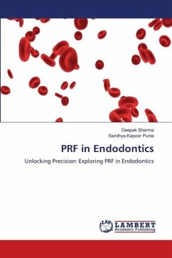 PRF in Endodontics - Sharma, Deepak;Punia, Sandhya Kapoor